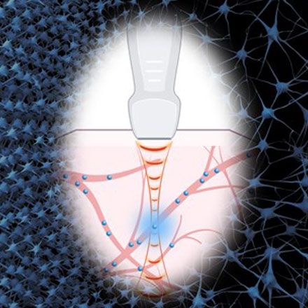 Seeing the Sound: Optical Neural Interfaces for In Vivo Neuromodulation
